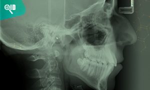 Ortho Imagen | Conoce el protocolo para la toma de Radiografías