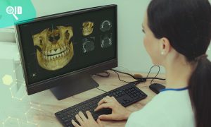 Ortho Imagen | El ABC de una Tomografía de Cráneo