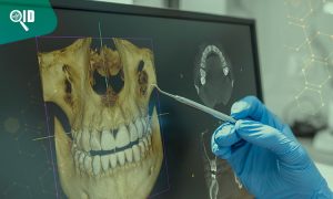 Ortho Imagen | Tomografía 3D ¿Qué ventajas tiene en el estudio de los dientes