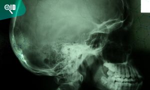 Ortho Imagen | Cefalometría ¿Cuál es su importancia en las radiografías dentales