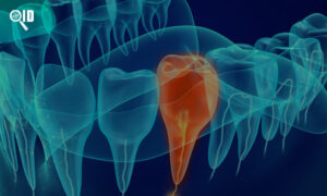 Ortho Imagen | Radiografía Dental 3D vs Panorámica ¿Cuál es más exacta