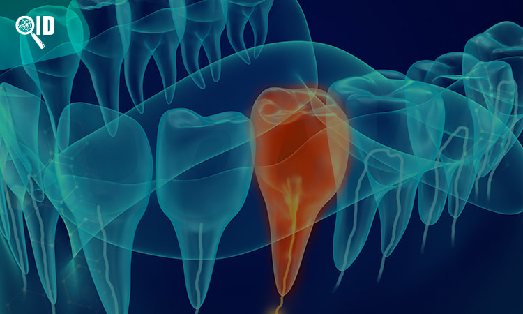 Ortho Imagen | Radiografía Dental 3D vs Panorámica ¿Cuál es más exacta