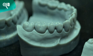 Ortho Imagen | Aplicaciones de la Estereolitografía 3D en la Odontología
