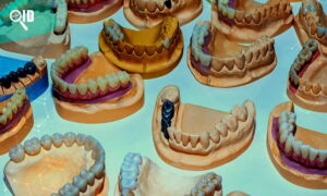 Ortho Imagen | Crea todo tipo de modelos maxilofaciales con Estereolitografía