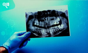 Ortho Imagen | ¿Qué necesitas para una Tomografía Computarizada de primera