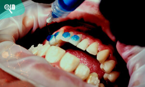 Ortho Imagen | Estudio Dental estrategia para colocar ortodoncia correctamente