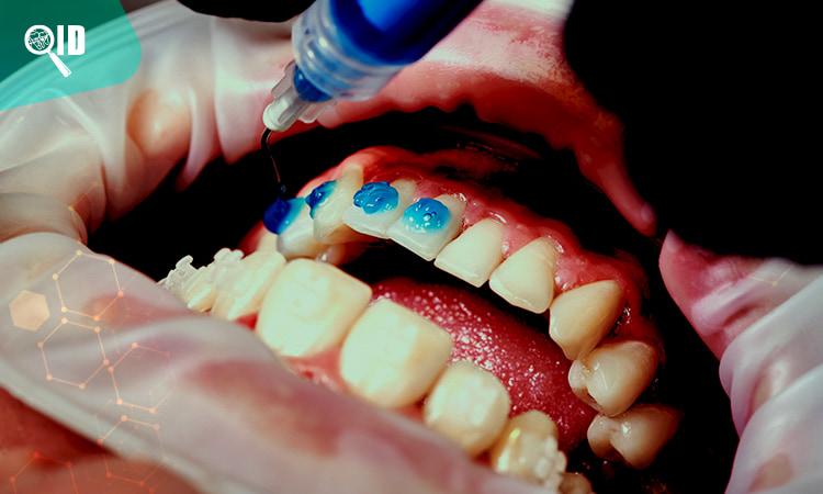 Ortho Imagen | Estudio Dental estrategia para colocar ortodoncia correctamente