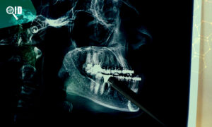 Ortho Imagen | Tomografía de Cabeza ¿Qué patologías dentales puede detectar