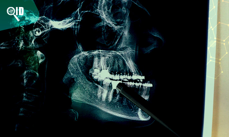 Ortho Imagen | Tomografía de Cabeza ¿Qué patologías dentales puede detectar