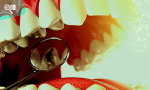 Ortho Imagen | Imagen Dental La realidad de la salud bucodental en el mundo