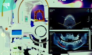 Ortho Imagen | Implicaciones de no retirar las joyas durante una Tomografía 3D