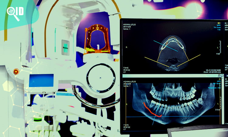 Ortho Imagen | Implicaciones de no retirar las joyas durante una Tomografía 3D