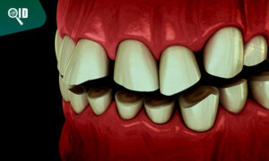 Ortho Imagen | Radiografía Dental y diagnóstico de Bruxismo en niños o adultos