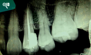 Ortho Imagen | ¿Cómo tener una Clínica Dental sin Servicio de Radiografías